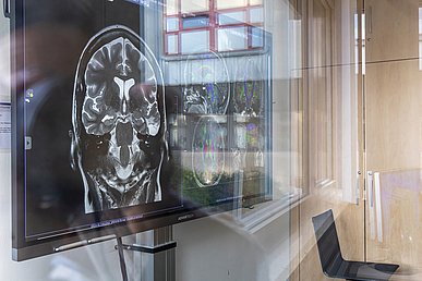 Blick durch eine Glasscheibe auf einem Bildschirm mit verschiedenen tomografischen Bildern eines menschlichen Schädels. Einige Hirnareale sind farbig hervorgehoben. In der Scheibe spiegelt sich teils ein Gebäudefassade.