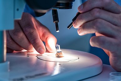 Dentale Fraktologie: Ursachenforschung in der Zahnklinik 1 – Zahnerhaltung und Parodontologie Auf einem Objektträger liegt unter dem Objektiv eines Mikroskops ein gebrochener Zahn auf dem ein Zylinder steht. Eine Hand hält den Objektträger, die andere leuchtet mit einer kleinen Stablampe auf den Zahn.