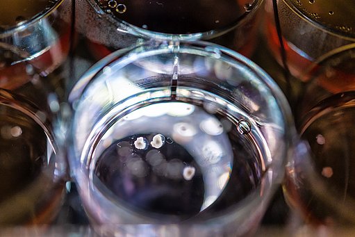 Nahaufnahme einer Petrischale aus Glas in der drei weiße organische Klümpchen schwimmen.