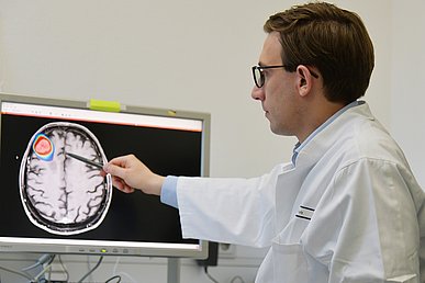 Mann im Arztkittel zeigt auf einem Monitor, auf dem ein Hirnscan zu sehen ist. Ein Hirnareal ist ellipsenförmig in verschiedenen Farben hervorgehoben.